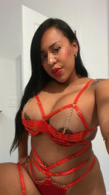 Xiomy listing photo