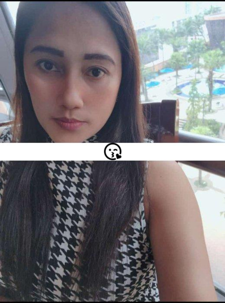 Rhea photo 1