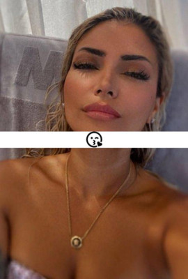 Buse listing photo