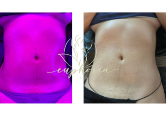 Euphoria Massage & Spa listing photo