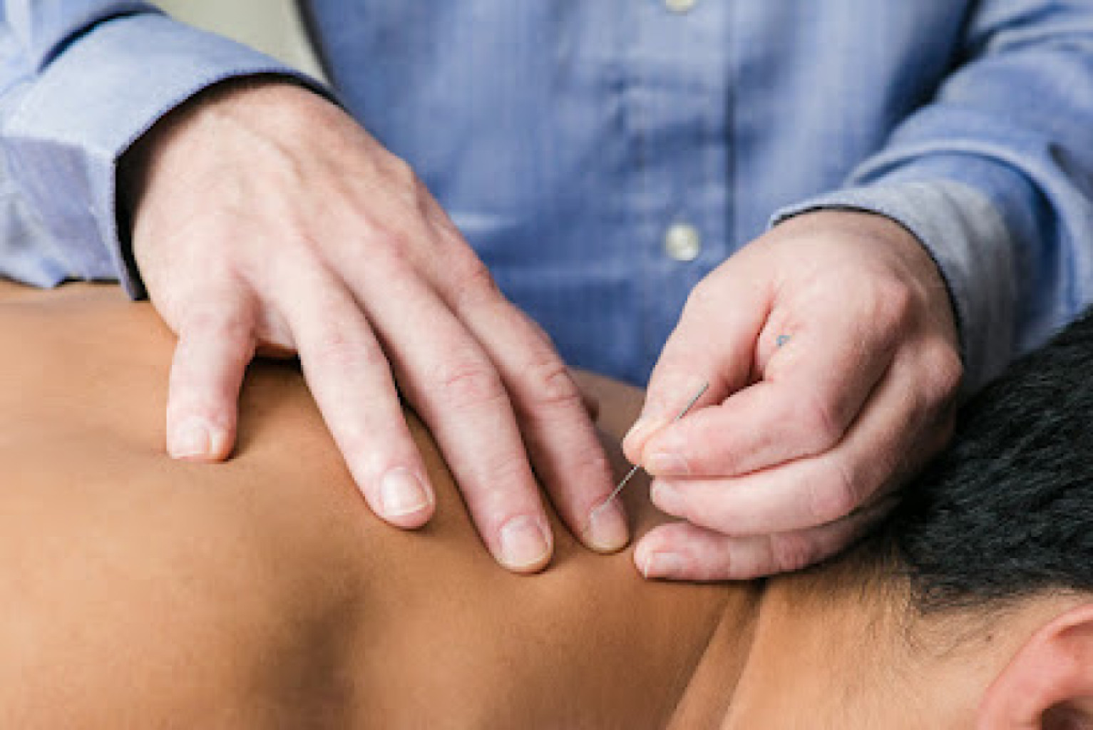 Sports Accupressure Therapy photo 1