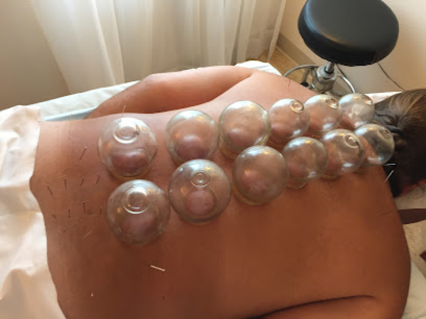 Acupuncture Of Iowa photo 1