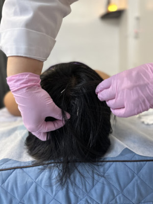 Accupressure listing photo