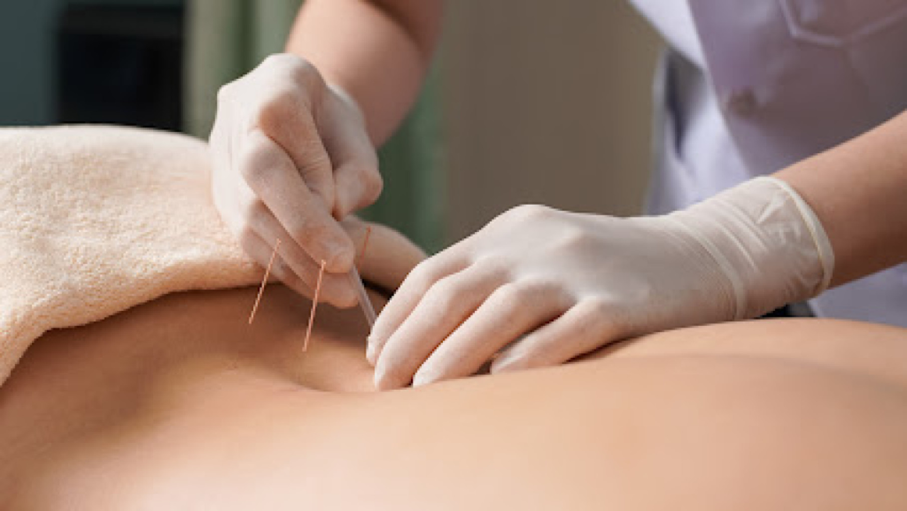 Xijing Acupuncture photo 1