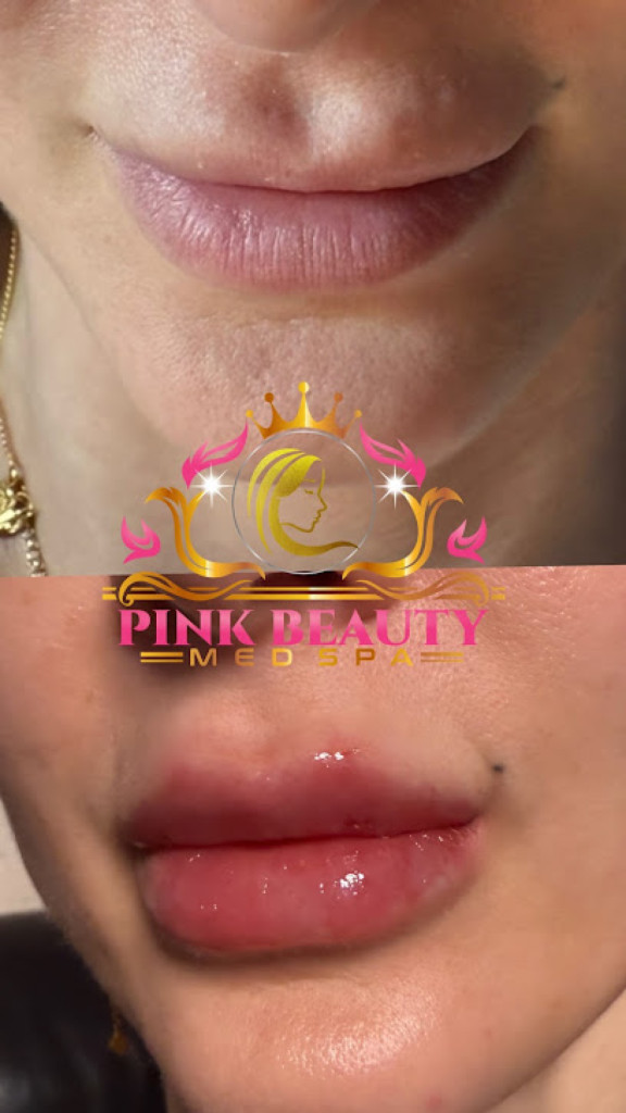 Pink Relaxation photo 1