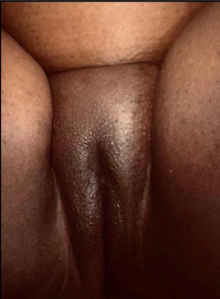 Juicy photo 1